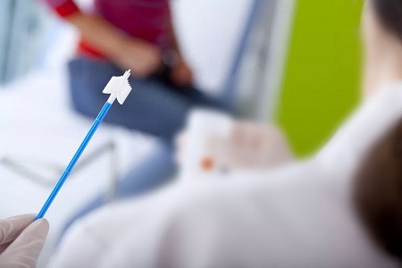 Progrese în screeningul cancerului de col uterin: rolul testelor de auto-colecție HPV