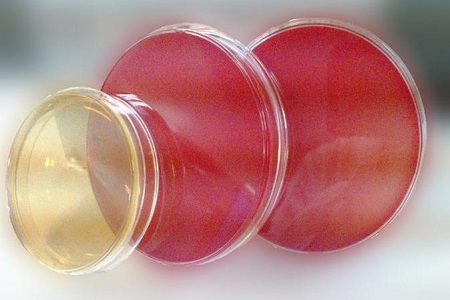 Salmonella Shigella Agar (SS): Mediul esențial pentru izolarea agentului patogen