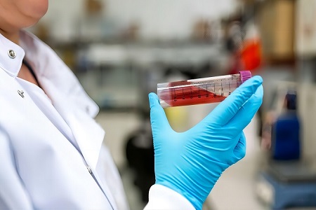 Kit de transport cu virus (neinactivat)-Colectarea probelor virale sigure