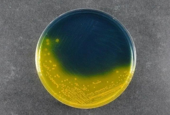 Asigurarea siguranței alimentelor: Agarul Salmonella Shigella de la Babio (SS) susține standardele globale de detectare a patogenilor