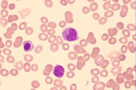 Babio lansează soluție de pete Giemsa de înaltă calitate pentru laboratoarele globale