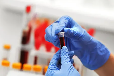 Detectarea rapidă a malariei: Kitul de testare cu antigen dublu de la BABIO dă putere sănătății globale