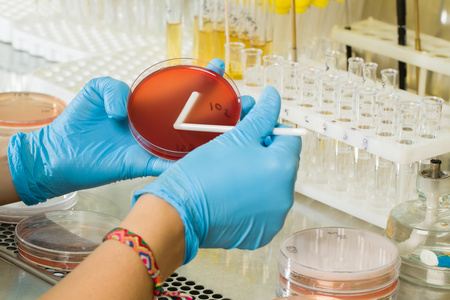 Mediu BABIO MacConkey Agar – Izolare selectivă premium pentru diagnosticul microbiologic global