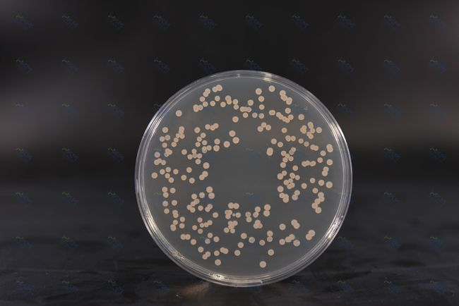 Baird Parker Agar: o soluție de încredere pentru detectarea Staphylococcus aureus de către BABIO