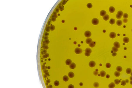 Bulionul BABIO Mueller-Hinton sprijină testarea de încredere a sensibilității antimicrobiene